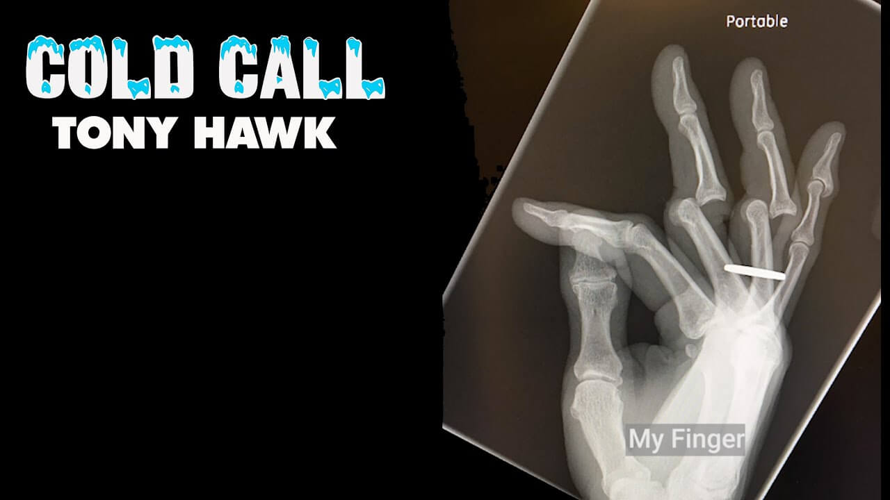 Tony Hawk Cold Call