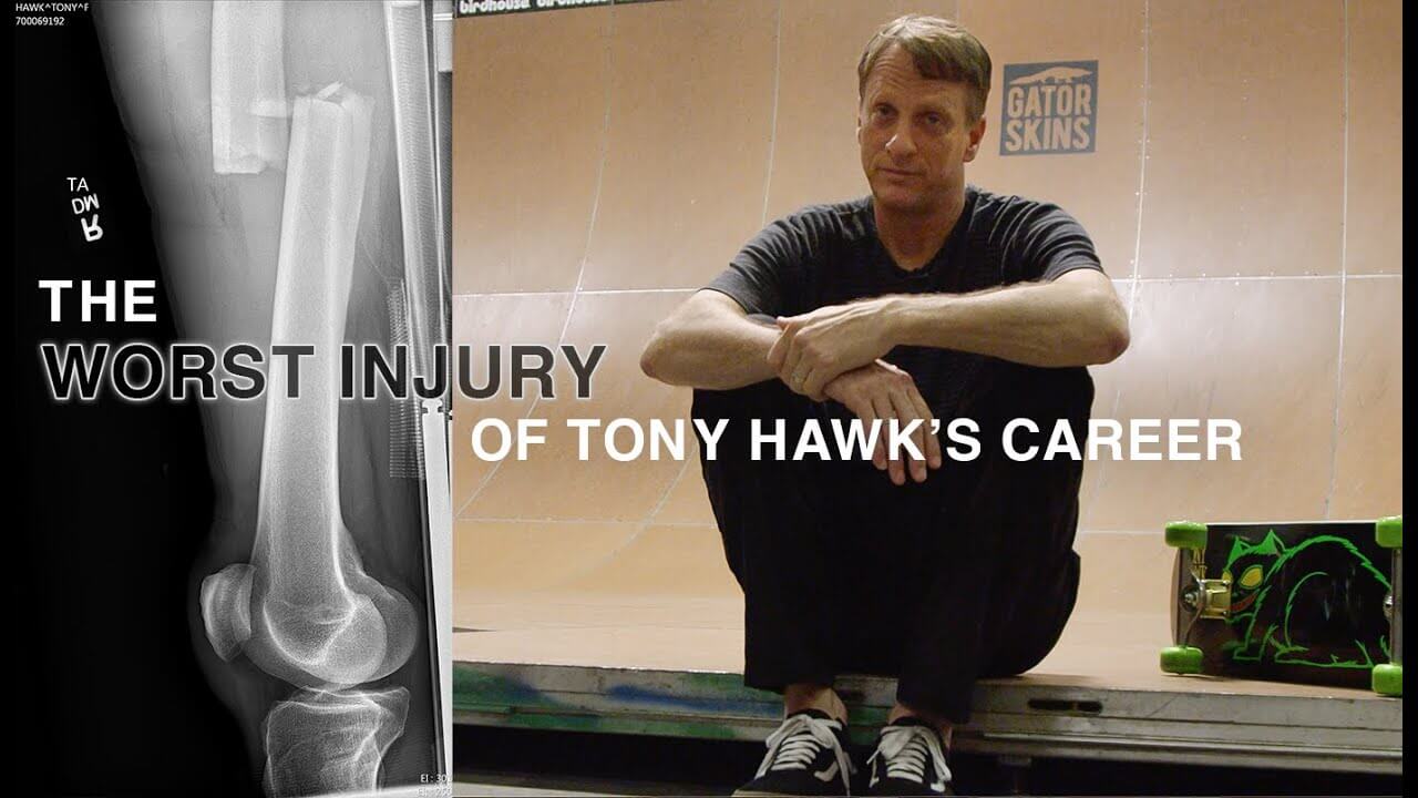 Tony Hawk on injuries